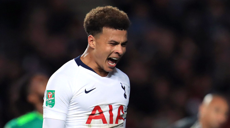 Dele Alli. Foto: PA Pictures/Scanpix